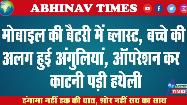 मोबाइल की बैटरी में ब्लास्ट, बच्चे की अलग हुई अंगुलियां, ऑपरेशन कर काटनी पड़ी हथेली