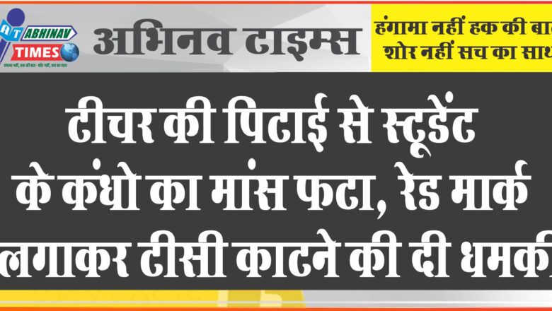 टीचर की पिटाई से स्टूडेंट के कंधे का मांस फटा:परिजनों के उलाहना देने पर धमकाया, रेड मार्क लगाकर टीसी काटने की धमकी